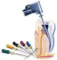 Perfect Smile ENDODONTICS